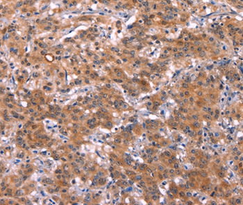 HMGCS1 Antibody