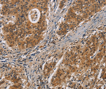 IL17D Antibody