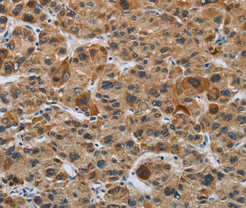 IL31 Antibody