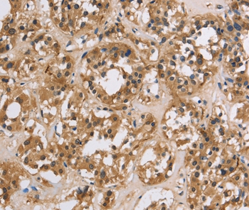 IMPDH1 Antibody