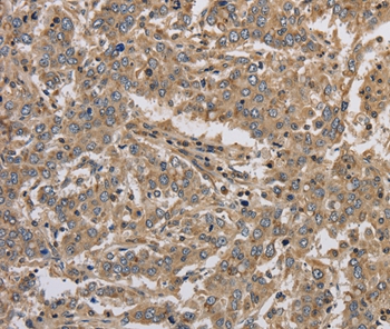 KCNMB3 Antibody