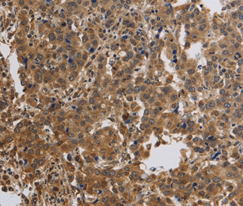 KCNMB4 Antibody