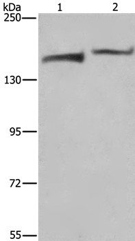 KDM5B Antibody