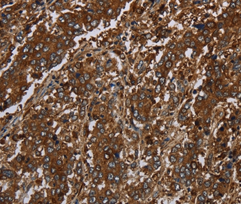 KLRF1 Antibody