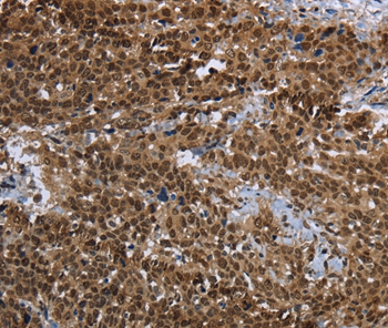 PRDM2 Antibody