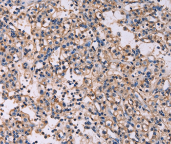 KSR1 Antibody