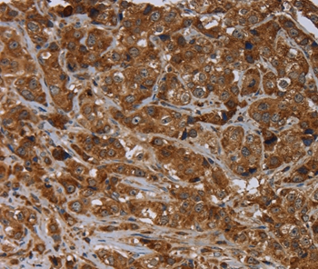 ARHGEF12 Antibody