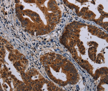 MAGEB3 Antibody