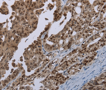 MAGEB18 Antibody