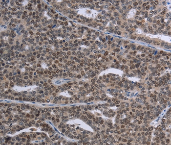 MAGEC1 Antibody