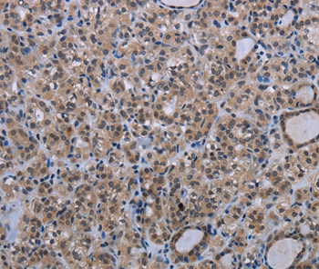 MAGEC1 Antibody