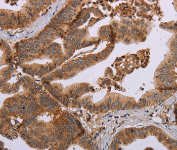 MFAP5 Antibody