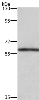 TBX5 Antibody