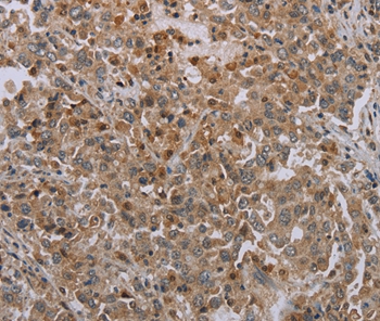 ERRFI1 Antibody