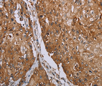 TNPO1 Antibody