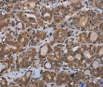 MTSS1 Antibody