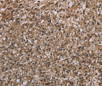 MYO18B Antibody