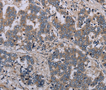 NLRP12 Antibody