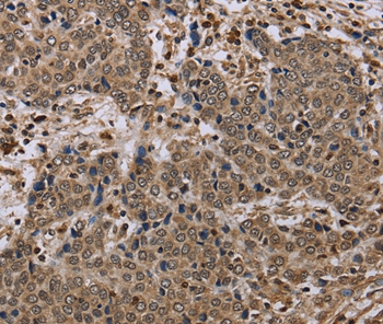 NLRP4 Antibody