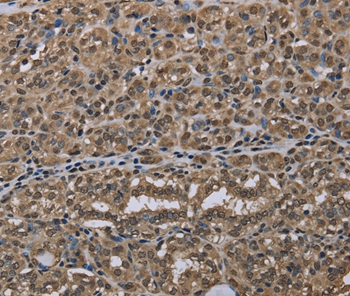 NLRP6 Antibody