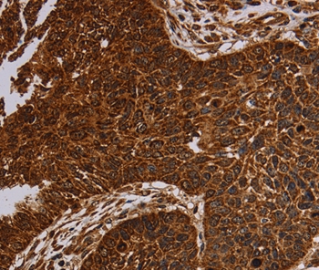 NDUFAB1 Antibody