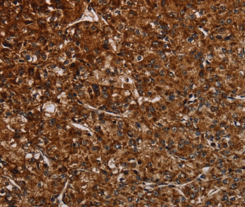 NDUFAB1 Antibody