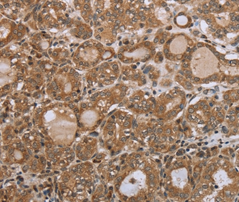 NDUFS2 Antibody