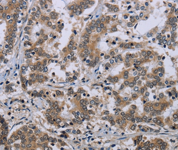 NEFH Antibody