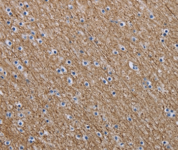 NEFM Antibody