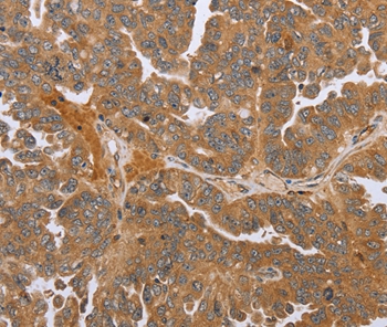 NMT1 Antibody