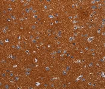 NOX3 Antibody