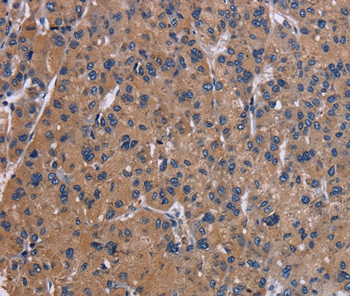 NPC1 Antibody