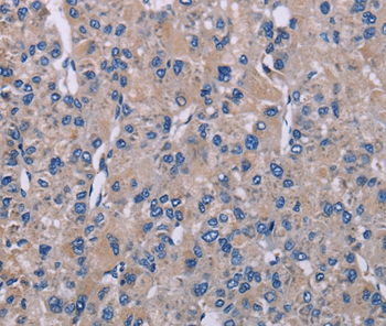 SH2D3A Antibody