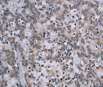 TP53AIP1 Antibody