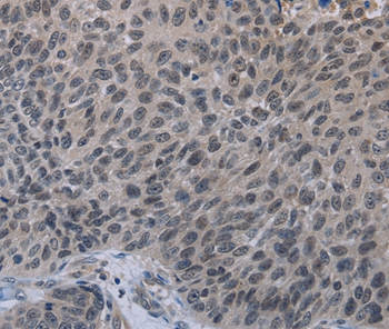 TP53AIP1 Antibody