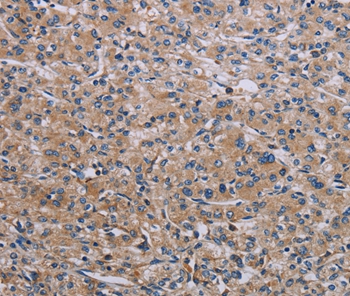 RPS6KB2 Antibody