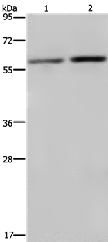 RPS6KB2 Antibody