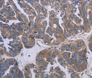 PARP4 Antibody