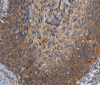 PARP10 Antibody