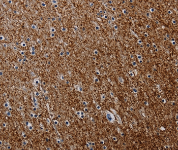 PCDHAC1 Antibody