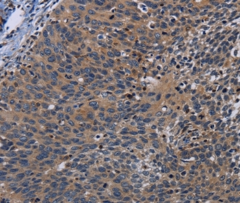 PCDHB15 Antibody