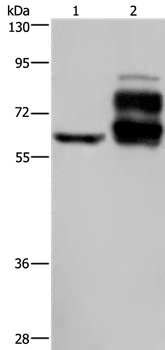 PCSK9 Antibody