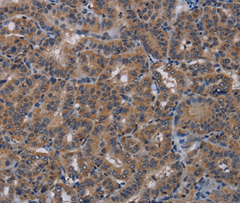 PDE4A Antibody