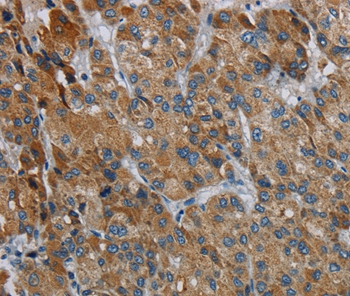 PDSS2 Antibody