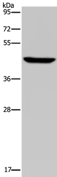 PDSS2 Antibody