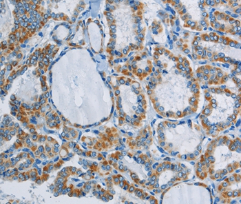 PPARGC1B Antibody - SAB | Signalway Antibody