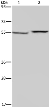 PHGDH Antibody