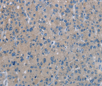 PHKA1 Antibody