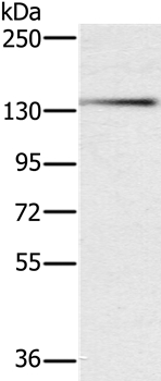 PHKA1 Antibody