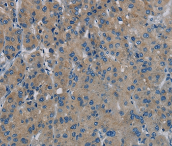 PHKG1 Antibody